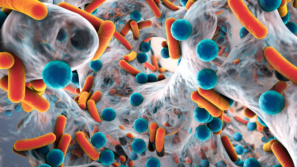 biofilm-DR