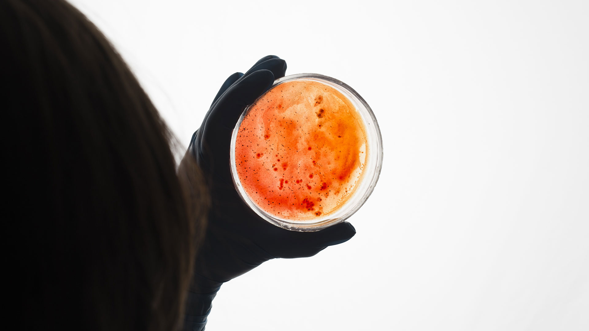 Microbial Diagnostics in a Biofilm World